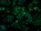 Aldehyde Dehydrogenase 2 Family Member antibody, GTX84890, GeneTex, Immunofluorescence image 