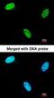 Protein Phosphatase 3 Catalytic Subunit Beta antibody, orb73682, Biorbyt, Immunofluorescence image 