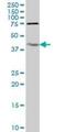 Interleukin 18 Binding Protein antibody, H00010068-M05, Novus Biologicals, Western Blot image 