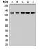 Glucosamine (UDP-N-Acetyl)-2-Epimerase/N-Acetylmannosamine Kinase antibody, LS-C668704, Lifespan Biosciences, Western Blot image 