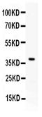 TNF Superfamily Member 11 antibody, PB10015, Boster Biological Technology, Western Blot image 