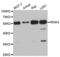 Interleukin 1 Receptor Associated Kinase 4 antibody, A6208, ABclonal Technology, Western Blot image 