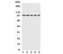 Progesterone Receptor antibody, R31442, NSJ Bioreagents, Western Blot image 