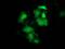 Heat Shock Protein Family B (Small) Member 8 antibody, MA5-25112, Invitrogen Antibodies, Immunocytochemistry image 