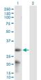 ADP Ribosylation Factor Like GTPase 6 Interacting Protein 6 antibody, H00151188-B02P, Novus Biologicals, Western Blot image 