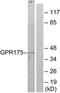 Transmembrane Protein Adipocyte Associated 1 antibody, TA316102, Origene, Western Blot image 