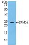 Toll Like Receptor 5 antibody, LS-C297849, Lifespan Biosciences, Western Blot image 