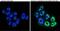Progesterone Receptor antibody, GTX30164, GeneTex, Immunofluorescence image 