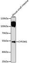Cytochrome P450 Family 2 Subfamily W Member 1 antibody, 15-189, ProSci, Western Blot image 
