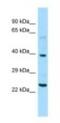 Nuclear Pore Complex Interacting Protein Family Member A1 antibody, NBP1-98540, Novus Biologicals, Western Blot image 