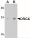 Dorsal Root Ganglia Homeobox antibody, NBP2-41138, Novus Biologicals, Western Blot image 