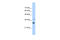 Nicotinamide Nucleotide Adenylyltransferase 1 antibody, ARP48889_T100, Aviva Systems Biology, Western Blot image 