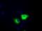 Transforming Acidic Coiled-Coil Containing Protein 3 antibody, GTX83533, GeneTex, Immunocytochemistry image 