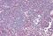 Zeta Chain Of T Cell Receptor Associated Protein Kinase 70 antibody, MBS245383, MyBioSource, Immunohistochemistry paraffin image 