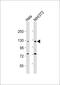 Serine/threonine-protein kinase LMTK1 antibody, M07846, Boster Biological Technology, Western Blot image 