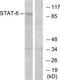 Signal Transducer And Activator Of Transcription 6 antibody, TA312080, Origene, Western Blot image 