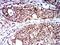 Interleukin 9 Receptor antibody, NBP2-61701, Novus Biologicals, Immunohistochemistry paraffin image 
