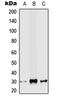 Snail Family Transcriptional Repressor 2 antibody, LS-C353781, Lifespan Biosciences, Western Blot image 