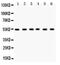 Dihydrolipoamide Dehydrogenase antibody, PA5-79157, Invitrogen Antibodies, Western Blot image 