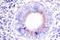 Protein Tyrosine Phosphatase Non-Receptor Type 6 antibody, LS-C176300, Lifespan Biosciences, Immunohistochemistry paraffin image 