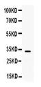 Three Prime Repair Exonuclease 1 antibody, PB9748, Boster Biological Technology, Western Blot image 