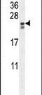 Phosphatidylinositol Glycan Anchor Biosynthesis Class X antibody, PA5-24023, Invitrogen Antibodies, Western Blot image 