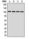 Mitogen-Activated Protein Kinase Kinase Kinase Kinase 3 antibody, LS-C668636, Lifespan Biosciences, Western Blot image 