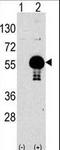 AKT Serine/Threonine Kinase 2 antibody, LS-C98939, Lifespan Biosciences, Western Blot image 