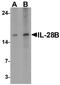 Interleukin-28B antibody, TA326656, Origene, Western Blot image 