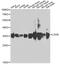 Lactate Dehydrogenase B antibody, STJ29762, St John