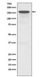 ATP Binding Cassette Subfamily B Member 1 antibody, M00049, Boster Biological Technology, Western Blot image 