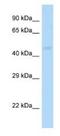 Gamma-Aminobutyric Acid Type A Receptor Pi Subunit antibody, NBP1-82390, Novus Biologicals, Western Blot image 