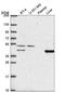 Phosphorylase Kinase Catalytic Subunit Gamma 2 antibody, NBP2-56609, Novus Biologicals, Western Blot image 