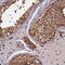 Proteasome 26S Subunit, ATPase 6 antibody, PA5-60140, Invitrogen Antibodies, Immunohistochemistry frozen image 
