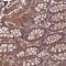 SKI/DACH Domain Containing 1 antibody, NBP1-81892, Novus Biologicals, Immunohistochemistry frozen image 
