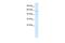 Cholinergic Receptor Nicotinic Alpha 5 Subunit antibody, GTX47703, GeneTex, Western Blot image 