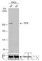 Tet Methylcytosine Dioxygenase 2 antibody, GTX124204, GeneTex, Western Blot image 