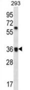 Olfactory Receptor Family 52 Subfamily E Member 2 antibody, abx026763, Abbexa, Western Blot image 