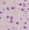 Rho GTPase Activating Protein 32 antibody, orb1859, Biorbyt, Immunohistochemistry paraffin image 