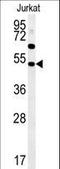 SAM Domain, SH3 Domain And Nuclear Localization Signals 1 antibody, LS-C162862, Lifespan Biosciences, Western Blot image 