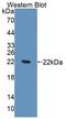 ATP Binding Cassette Subfamily E Member 1 antibody, LS-C663359, Lifespan Biosciences, Western Blot image 