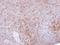 Tubulin Folding Cofactor B antibody, LS-C185446, Lifespan Biosciences, Immunohistochemistry frozen image 