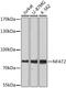 Nuclear Factor Of Activated T Cells 1 antibody, GTX33355, GeneTex, Western Blot image 