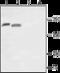 Sodium Voltage-Gated Channel Alpha Subunit 10 antibody, GTX16972, GeneTex, Western Blot image 