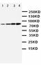 Phosphoinositide-3-Kinase Regulatory Subunit 1 antibody, LS-C312573, Lifespan Biosciences, Western Blot image 