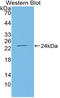 TNF Receptor Superfamily Member 11a antibody, LS-C314881, Lifespan Biosciences, Western Blot image 