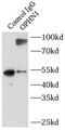 Oligophrenin 1 antibody, FNab05988, FineTest, Immunoprecipitation image 