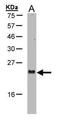 ADP Ribosylation Factor Like GTPase 2 antibody, PA5-27091, Invitrogen Antibodies, Western Blot image 
