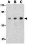 Apoptosis Antagonizing Transcription Factor antibody, GTX85086, GeneTex, Western Blot image 