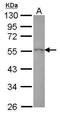 Drebrin Like antibody, GTX118543, GeneTex, Western Blot image 